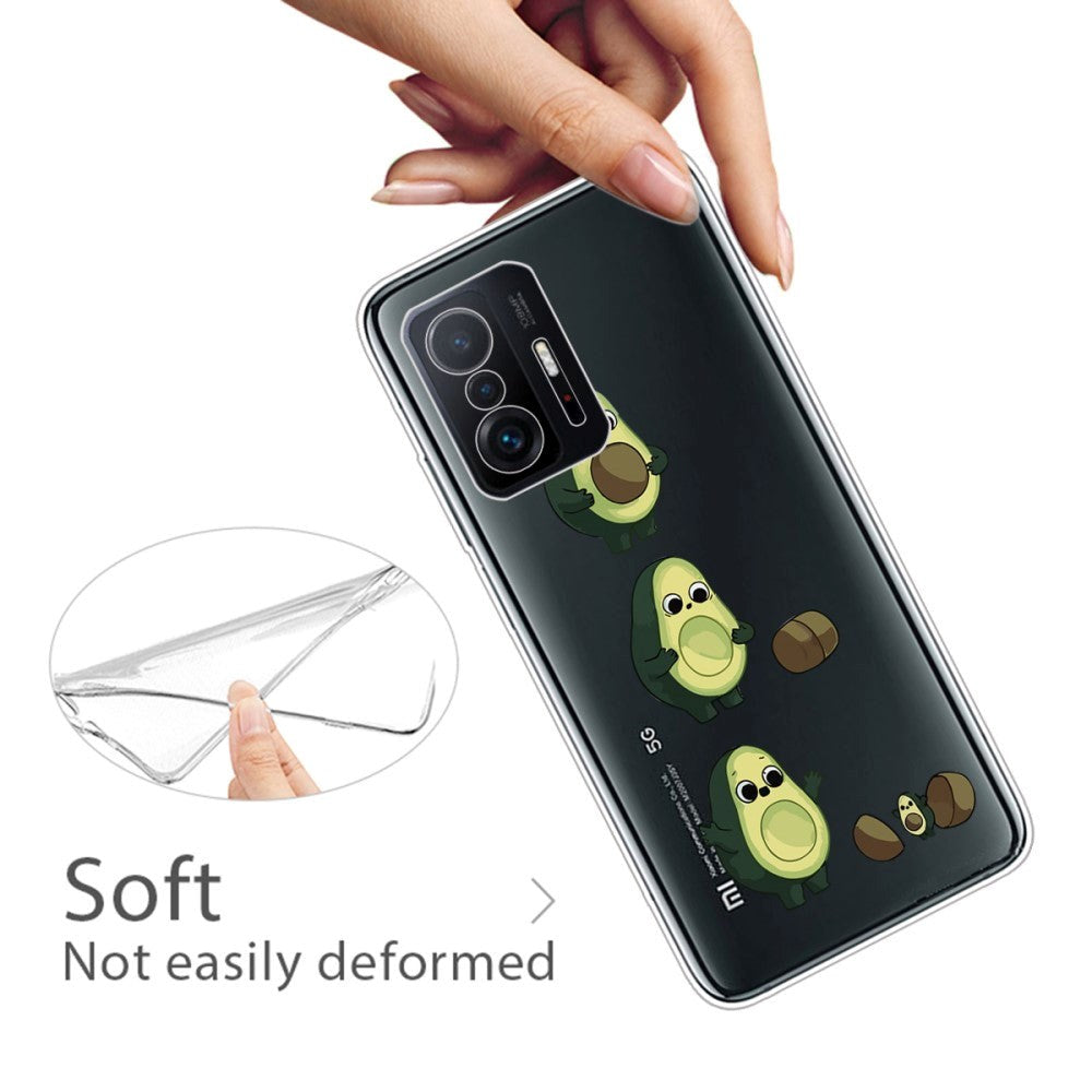 Xiaomi 11T / 11T Pro Fleksibelt Plastik Bagside Cover m. Print - Avocado