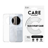 Honor 400 Lite - CARE by PanzerGlass Fashionable Transparent X-Ray Soft Basic Cover - Gennemsigtig